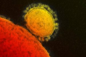 Read more about the article Veja perguntas e respostas mais frequentes sobre o surto de coronavírus no mundo