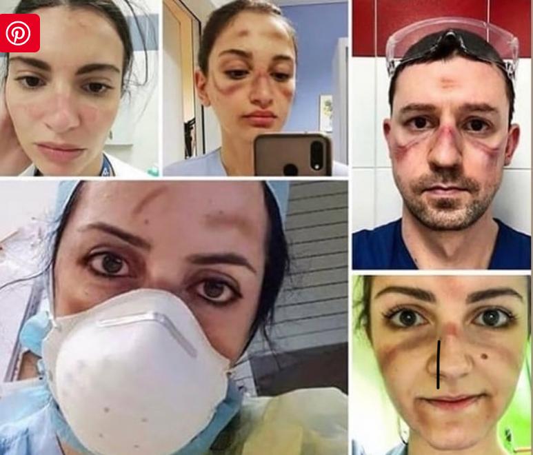 Você está visualizando atualmente Médicos fazem selfie para mostrar dias combatendo o coronavírus