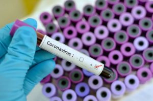 Read more about the article Amazonas soma 1.206 casos do novo coronavírus e 62 mortes