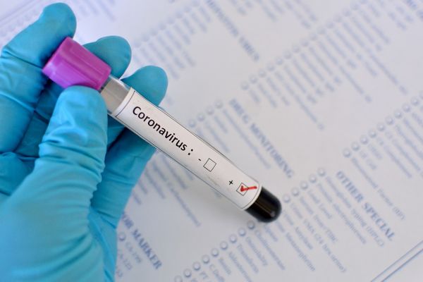 Você está visualizando atualmente Brasil registra mais de 20 mil casos de coronavírus