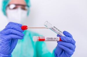 Read more about the article Governo federal pode ter de jogar no lixo 6,86 milhões de testes de coronavírus