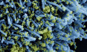 Descoberta nova variante do coronavírus com grande número de mutações
