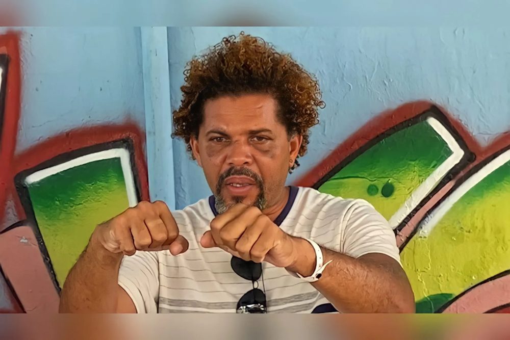 You are currently viewing Morador de rua agredido por personal diz que votou em Bolsonaro e votará outra vez: “Com muito orgulho”