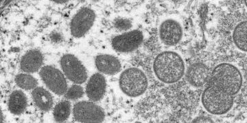 Ministério da Saúde confirma primeira morte por varíola dos macacos no país