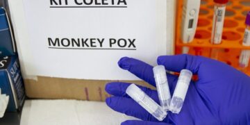 Sobe para 12 o número de casos suspeitos de varíola dos macacos no Amazonas